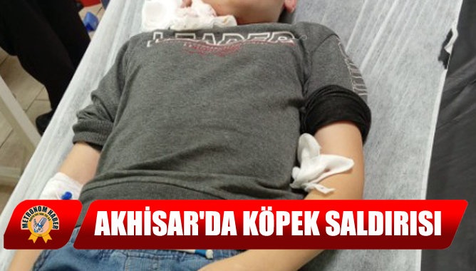 Akhisar'da Köpek Saldırısı