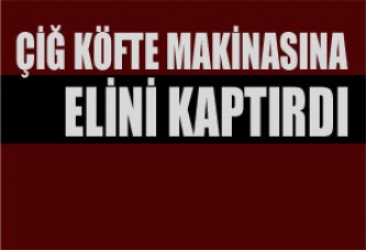 ELİNİ ÇİĞKÖFTE MAKİNESİNE KAPTIRDI