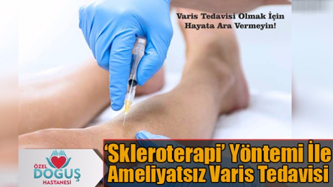 ‘Skleroterapi’ Yöntemi İle Ameliyatsız Varis Tedavisi