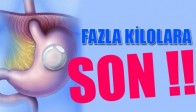 Ameliyatsız Mide Balonu İle Kilo Fazlalığına Son