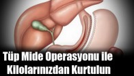 Tüp Mide Operasyonu ile Kilolarınızdan Kurtulun